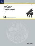 Cardiogramme 