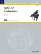 Cardiogramme 