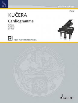 Cardiogramme 